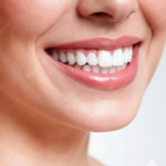 Close-up of healthy white teeth following teeth whitening Denver procedure.