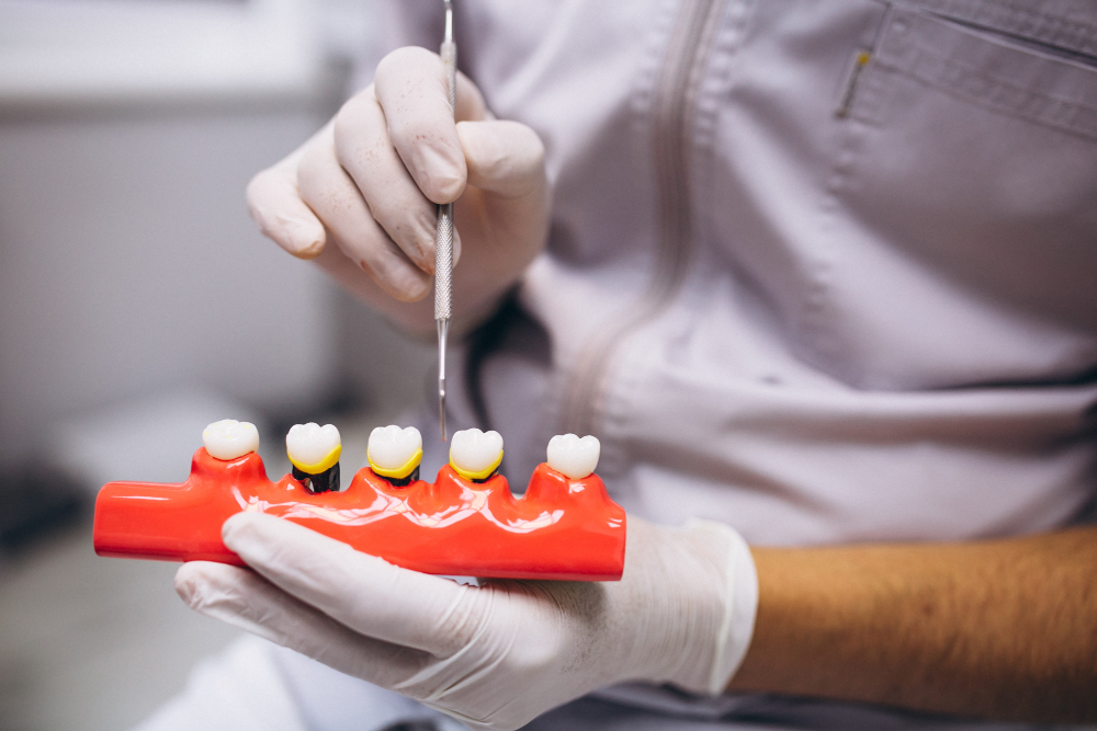 Dental professional adjusting artificial teeth on a model for restorative dentistry treatment.